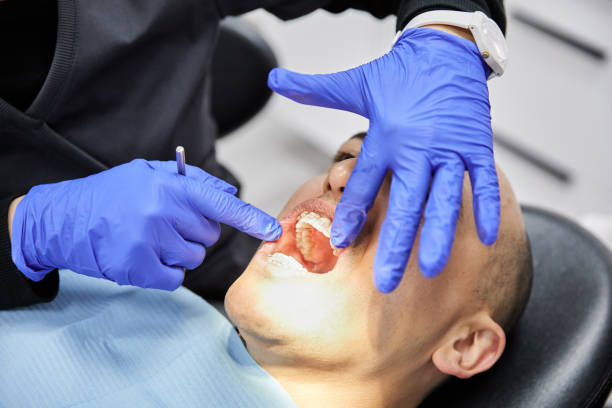 Best Dentist for Tooth Abscess  in Pingree Grove, IL
